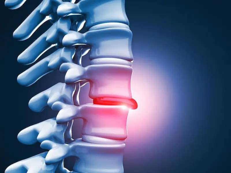 Orthopedic Spine Specialist